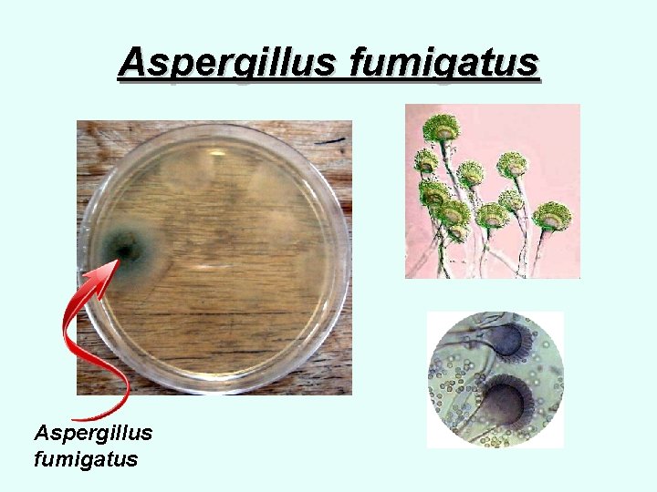 Aspergillus fumigatus 