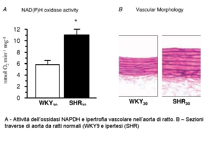 A - Attività dell’ossidasi NAPDH e ipertrofia vascolare nell’aorta di ratto. B – Sezioni