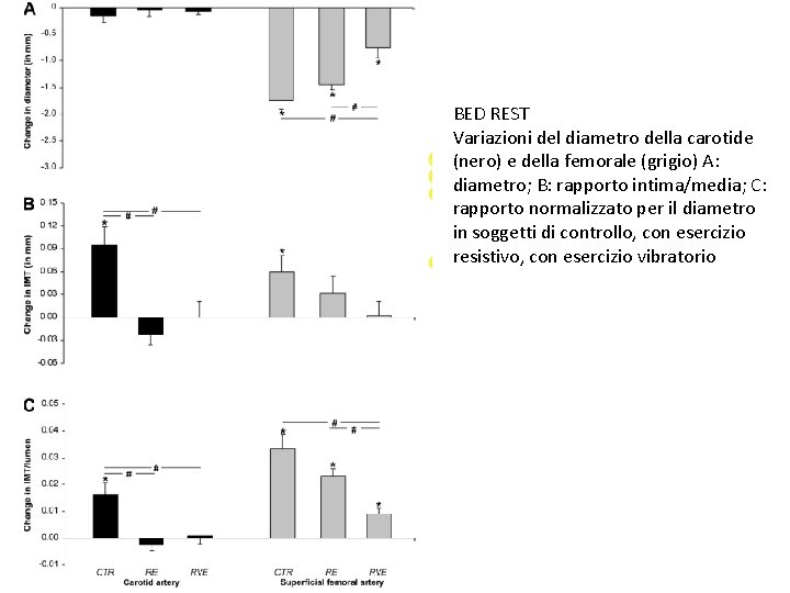 BED REST Variazioni del diametro della carotide (nero) e della femorale (grigio) A: diametro;