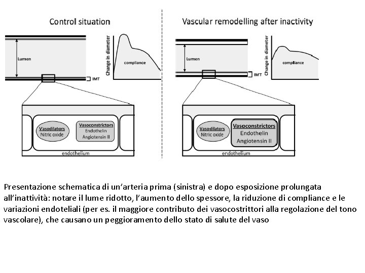 Presentazione schematica di un’arteria prima (sinistra) e dopo esposizione prolungata all’inattività: notare il lume