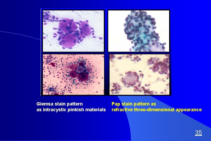 what cancers can ca125 detect