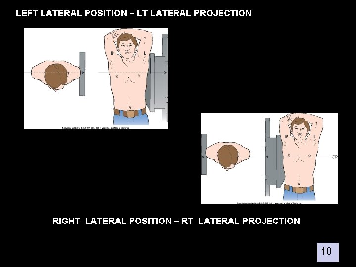 LEFT LATERAL POSITION – LT LATERAL PROJECTION RIGHT LATERAL POSITION – RT LATERAL PROJECTION