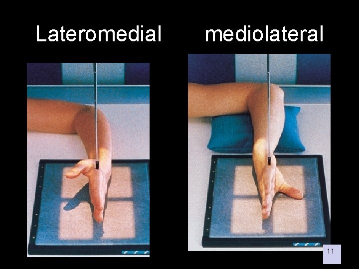 Lateromedial mediolateral 11 