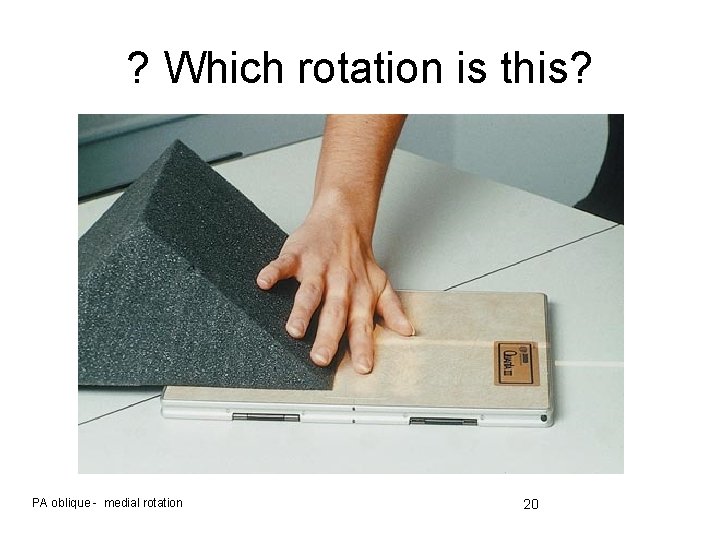 ? Which rotation is this? PA oblique - medial rotation 20 