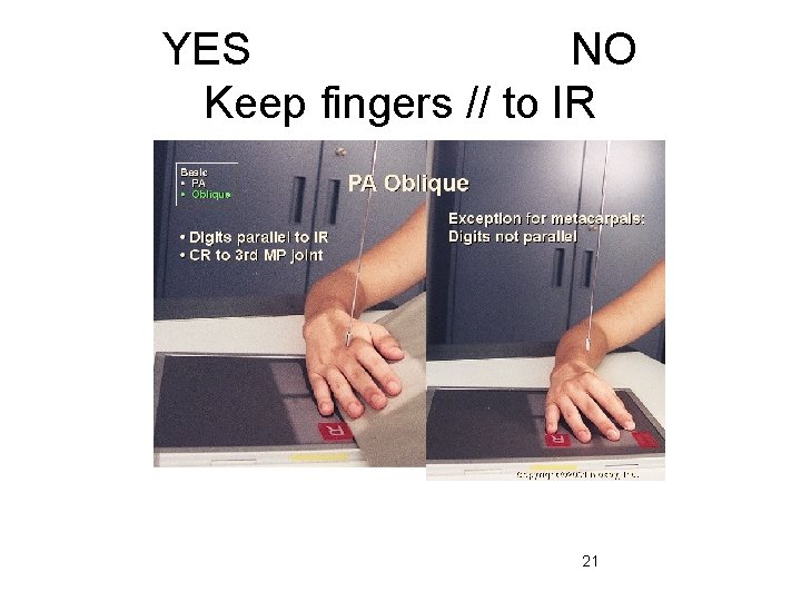 YES NO Keep fingers // to IR 21 