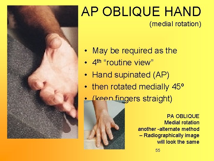 AP OBLIQUE HAND (medial rotation) • • • May be required as the 4