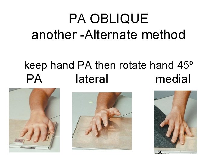 PA OBLIQUE another -Alternate method keep hand PA then rotate hand 45º PA lateral