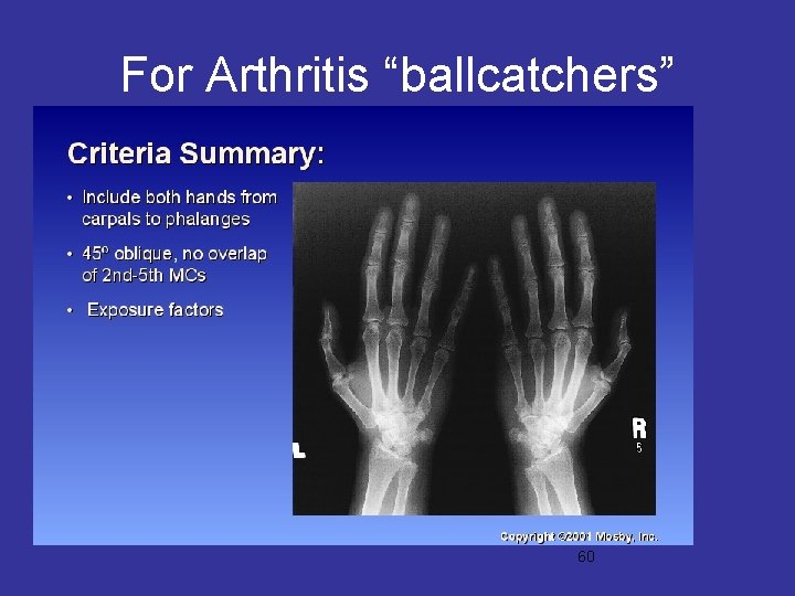 For Arthritis “ballcatchers” 60 