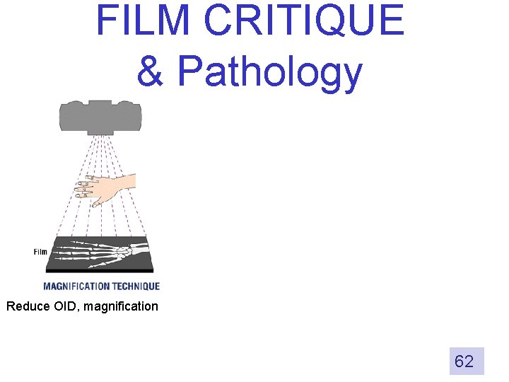 FILM CRITIQUE & Pathology Reduce OID, magnification 62 