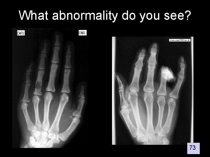 What abnormality do you see? 73 