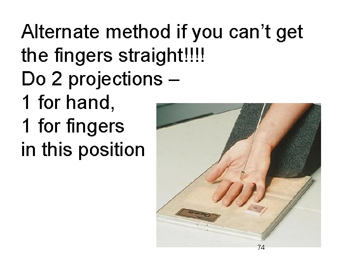 Alternate method if you can’t get the fingers straight!!!! Do 2 projections – 1