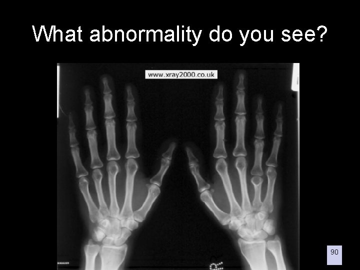What abnormality do you see? 90 