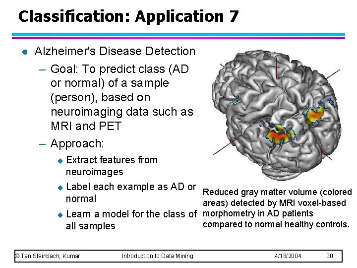 Classification: Application 7 l Alzheimer's Disease Detection – Goal: To predict class (AD or