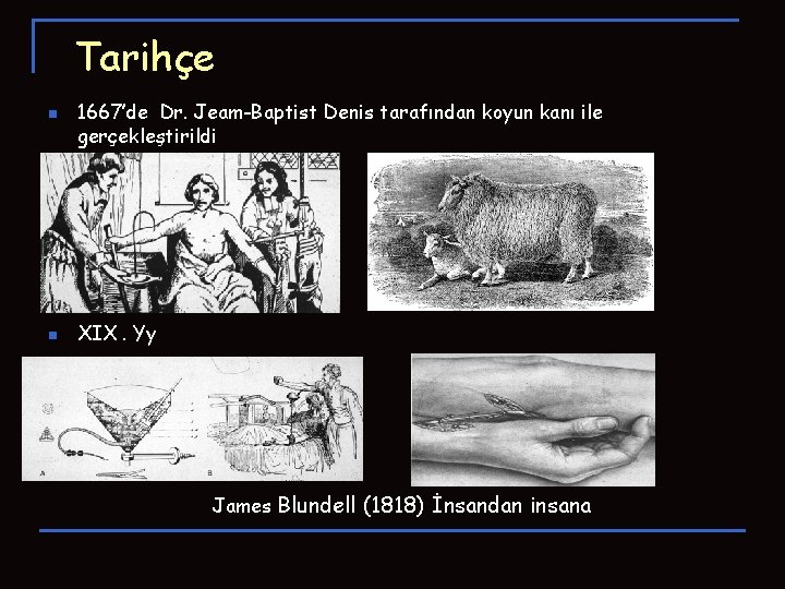 Tarihçe n n 1667’de Dr. Jeam-Baptist Denis tarafından koyun kanı ile gerçekleştirildi XIX. Yy Tarihçe n n 1667’de Dr. Jeam-Baptist Denis tarafından koyun kanı ile gerçekleştirildi XIX. Yy