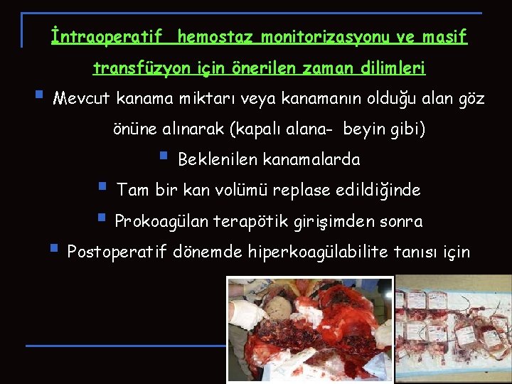 İntraoperatif hemostaz monitorizasyonu ve masif transfüzyon için önerilen zaman dilimleri § Mevcut kanama miktarı İntraoperatif hemostaz monitorizasyonu ve masif transfüzyon için önerilen zaman dilimleri § Mevcut kanama miktarı
