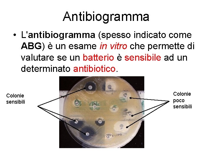 Antibiogramma • L'antibiogramma (spesso indicato come ABG) è un esame in vitro che permette