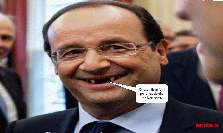 Pétard, ils m ’ont pété les dents les Romanos. Pétard, ils m ’ont pété les dents les Romanos.