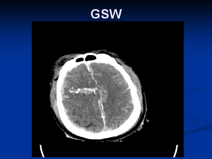 GSW 