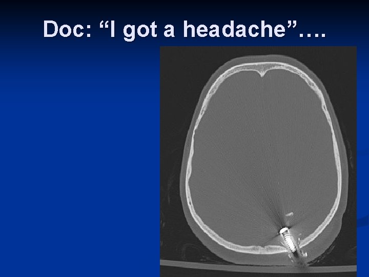 Doc: “I got a headache”…. 