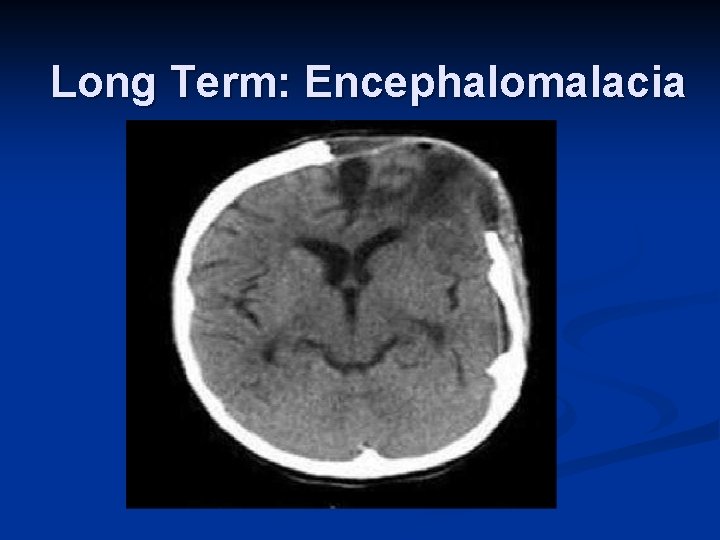 Long Term: Encephalomalacia 