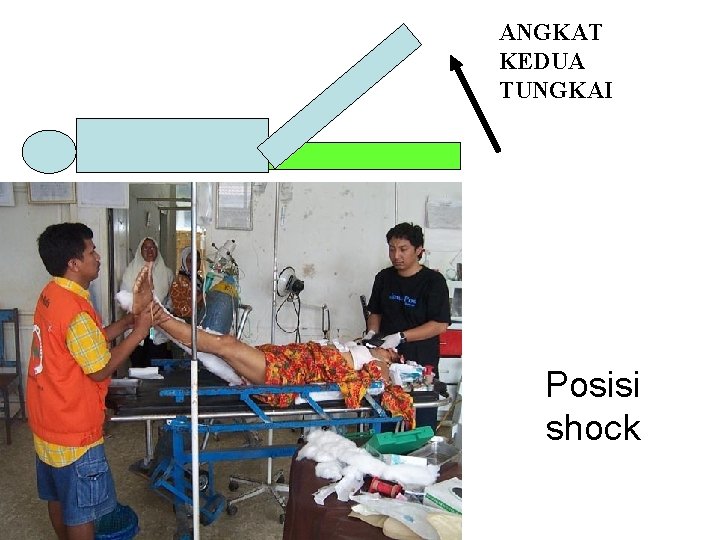 ANGKAT KEDUA TUNGKAI Posisi shock naik 