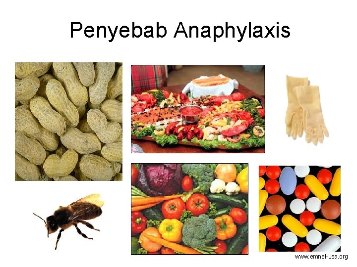 Penyebab Anaphylaxis www. emnet-usa. org 