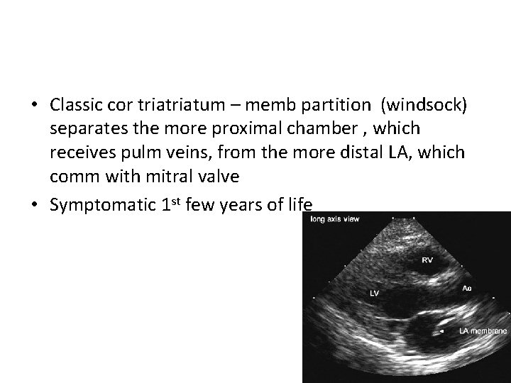  • Classic cor triatum – memb partition (windsock) separates the more proximal chamber