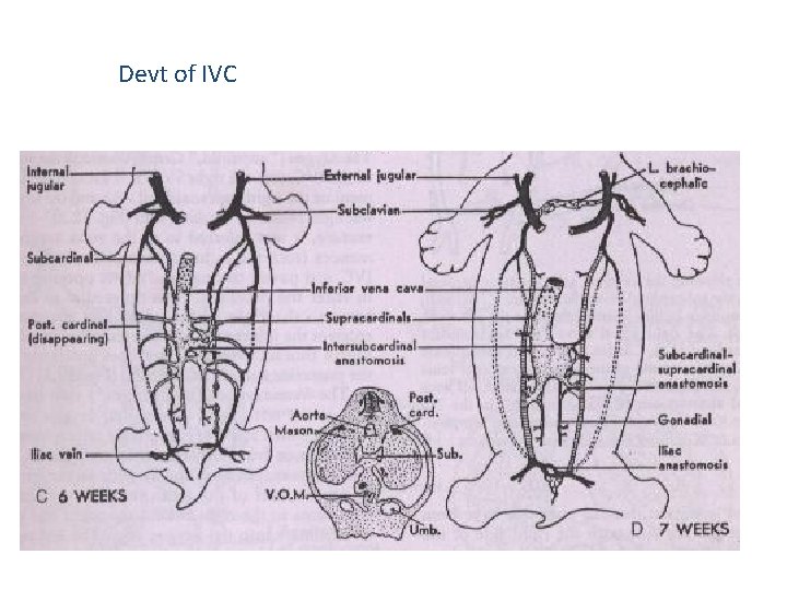 Devt of IVC 