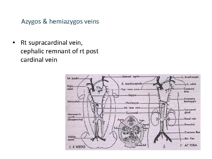 Azygos & hemiazygos veins • Rt supracardinal vein, cephalic remnant of rt post cardinal