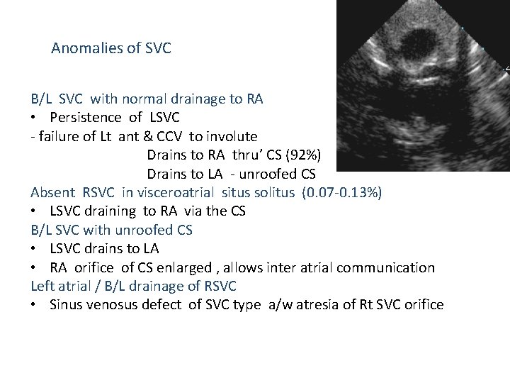 Anomalies of SVC B/L SVC with normal drainage to RA • Persistence of LSVC