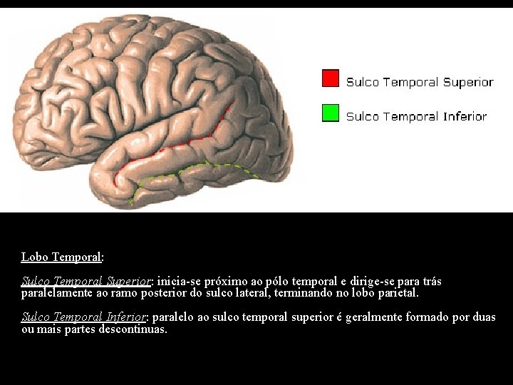 Lobo Temporal: Sulco Temporal Superior: inicia-se próximo ao pólo temporal e dirige-se para trás