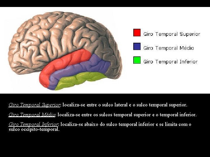 Giro Temporal Superior: localiza-se entre o sulco lateral e o sulco temporal superior. Giro
