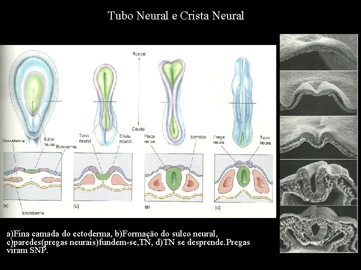 Tubo Neural e Crista Neural a)Fina camada do ectoderma, b)Formação do sulco neural, c)paredes(pregas