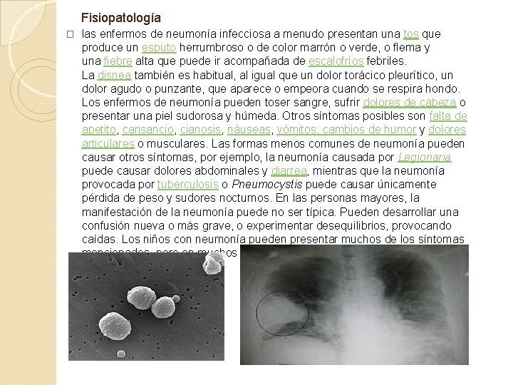 Fisiopatología � las enfermos de neumonía infecciosa a menudo presentan una tos que produce