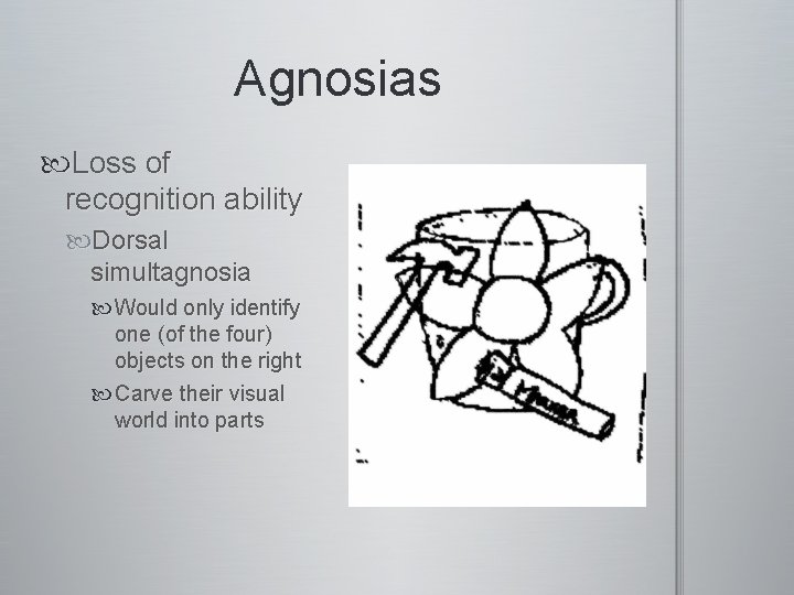 Agnosias Loss of recognition ability Dorsal simultagnosia Would only identify one (of the four) Agnosias Loss of recognition ability Dorsal simultagnosia Would only identify one (of the four)