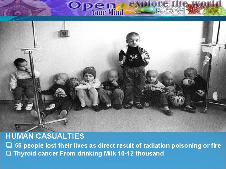 HUMAN CASUALTIES q 56 people lost their lives as direct result of radiation poisoning HUMAN CASUALTIES q 56 people lost their lives as direct result of radiation poisoning