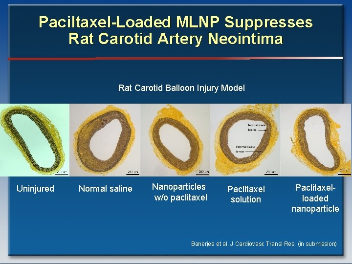 Paciltaxel-Loaded MLNP Suppresses Rat Carotid Artery Neointima Rat Carotid Balloon Injury Model Uninjured Normal