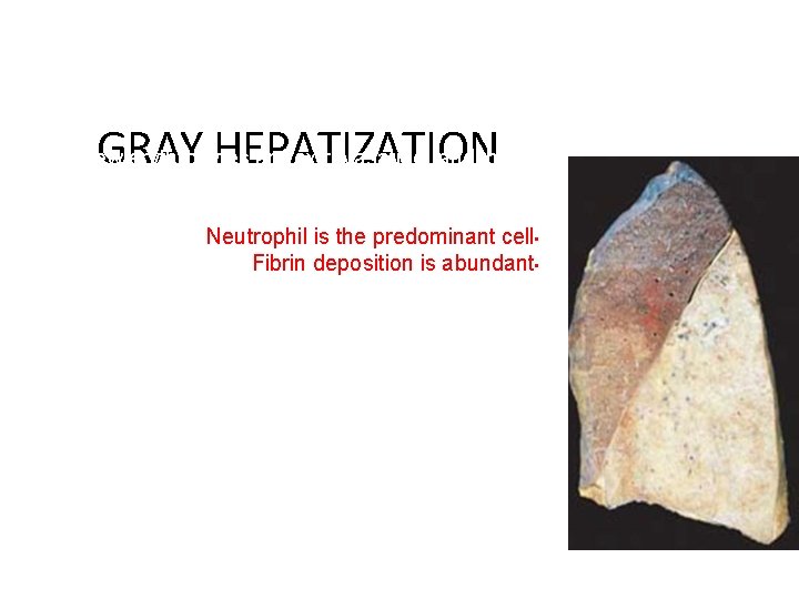 GRAY HEPATIZATION No new erythrocytes are extravasating, and those • already present have been