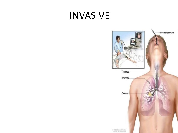 INVASIVE Bronchoscopy • Thoracoscopy • Percutaneous aspiration/biopsy • Open lung biopsy • Pleural aspiration