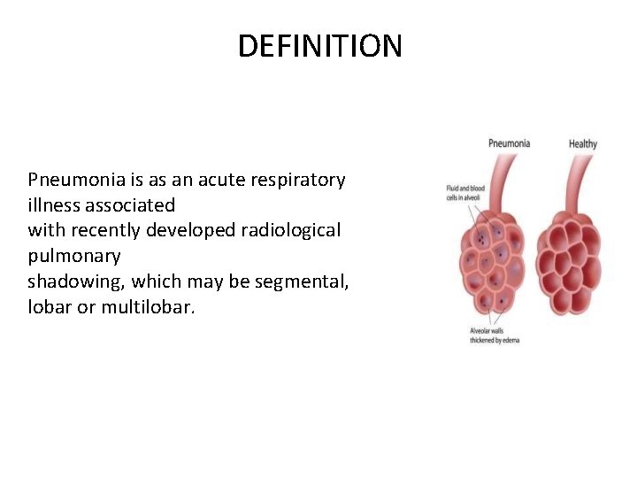 DEFINITION It is as an acute respiratory illness associated with recently developed Pneumonia is