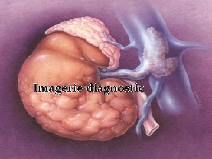 Imagerie diagnostic 