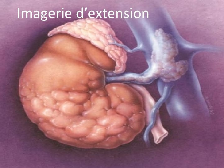 Imagerie d’extension 