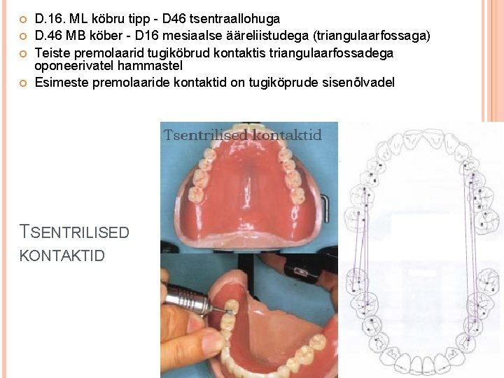  D. 16. ML köbru tipp - D 46 tsentraallohuga D. 46 MB köber