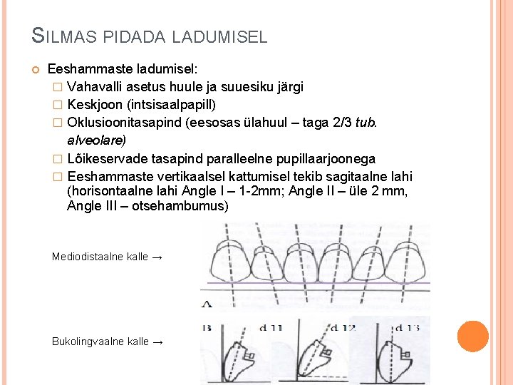 SILMAS PIDADA LADUMISEL Eeshammaste ladumisel: � Vahavalli asetus huule ja suuesiku järgi � Keskjoon