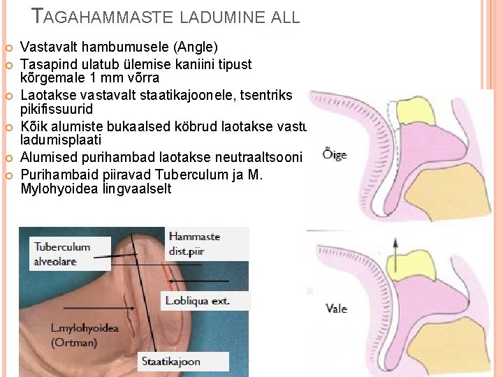 TAGAHAMMASTE LADUMINE ALL Vastavalt hambumusele (Angle) Tasapind ulatub ülemise kaniini tipust kõrgemale 1 mm