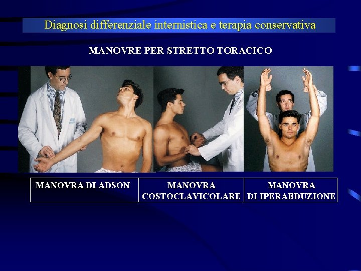 Diagnosi differenziale internistica e terapia conservativa MANOVRE PER STRETTO TORACICO MANOVRA DI ADSON MANOVRA