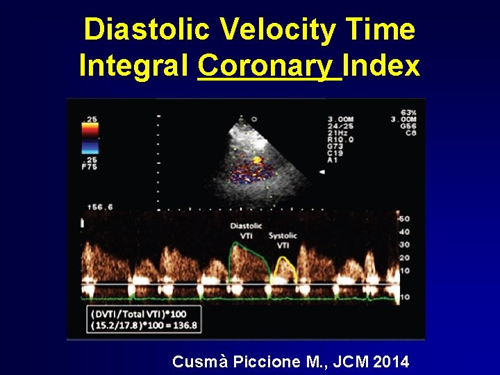 Diastolic Velocity Time Integral Coronary Index Cusmà Piccione M. , JCM 2014 