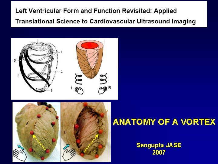 ANATOMY OF A VORTEX Sengupta JASE 2007 