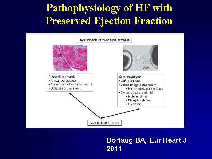 Pathophysiology of HF with Preserved Ejection Fraction Borlaug BA, Eur Heart J 2011 