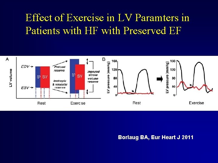Effect of Exercise in LV Paramters in Patients with HF with Preserved EF Borlaug